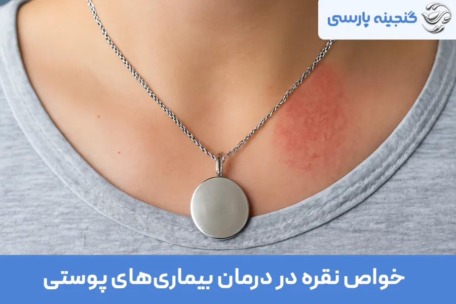 خواص نقره در درمان بیماری‌های پوستی